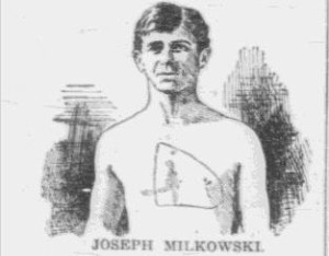 Edward Lewis/Joseph Milkowski, with his heart marked on his chest by an examining doctor. 
