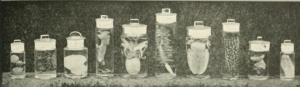 A Visceral Haunting Jars of preserved viscera